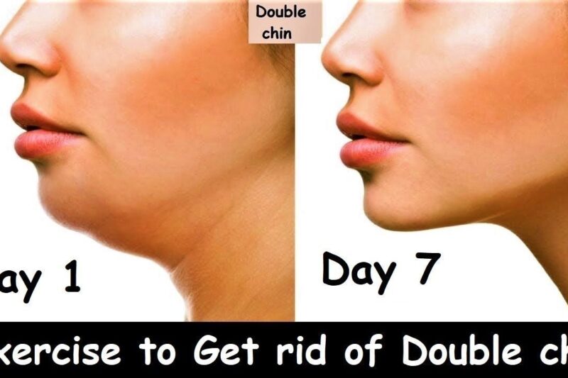 Reddit’s Guide to Banishing Face Fat and Double Chin: Proven Strategies & Real Results