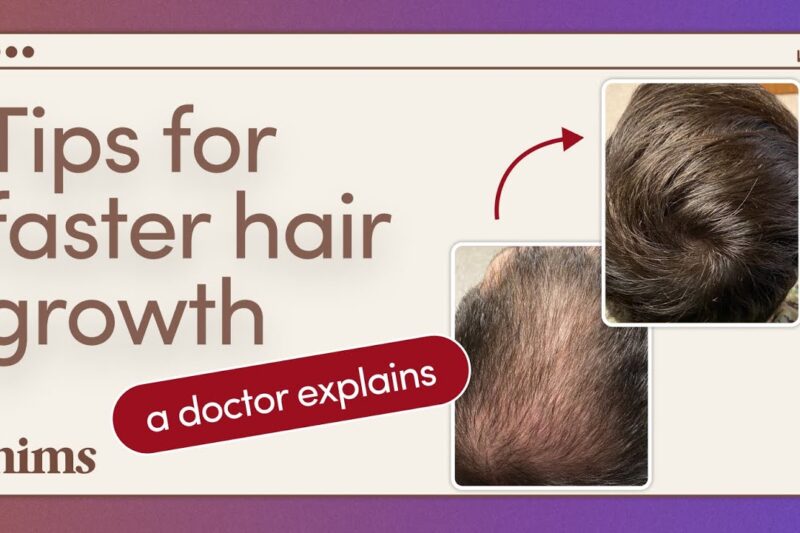 Unlock Your Hair’s Potential: The Ultimate Guide to Rapid Hair Growth for Boys