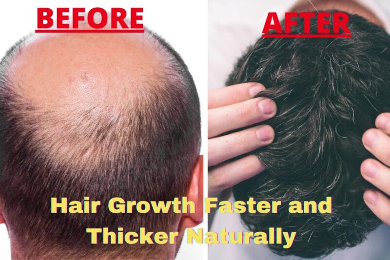 Unlock Rapid Hair Growth: Proven Techniques and Reddit’s Best Kept Secrets