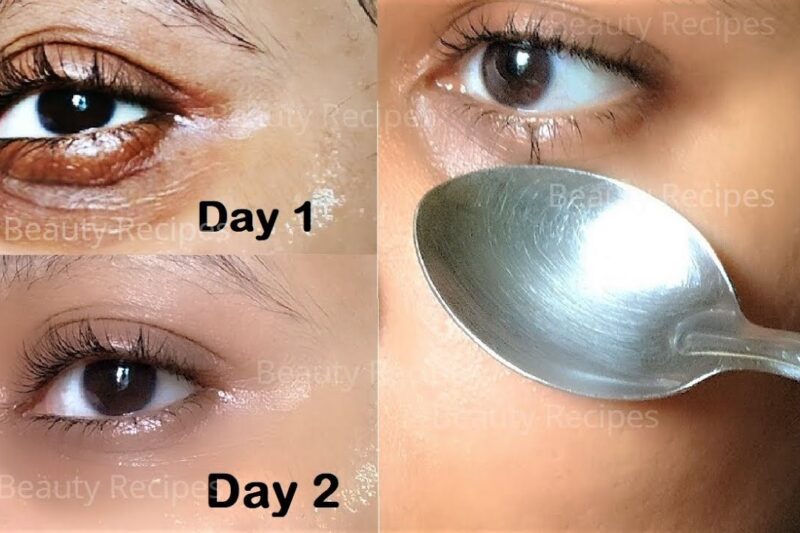 Bye Bye Baggage: Effortless Ways to Ditch Those Pesky Eye Bags (Even Without a Full Night’s Sleep!)